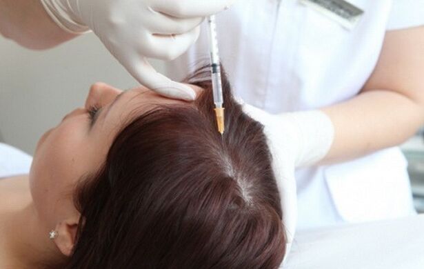 Mezoterapija u liječenju ženske alopecije