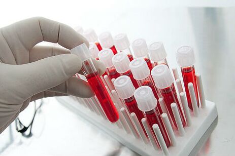 Test krvi za propisivanje individualnog liječenja alopecije